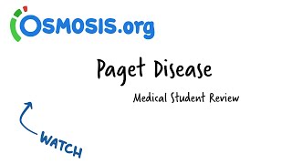 Paget Disease Osmosis Study Video [upl. by Nevin]