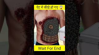 पेट मे कीड़े हो गए 😱 got stomach worms 3d animation youtube shorts [upl. by Goldman781]