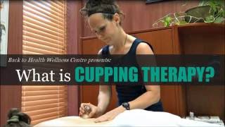 What is Cupping How Does Cupping Therapy Work  Back to Health Wellness Centre [upl. by Llehsar]