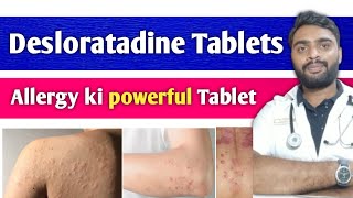 Allergy Ki Number 1 Tablet  Desloratadine tablets 5 mg Desloratadie tablets 10 mg [upl. by Relyks]