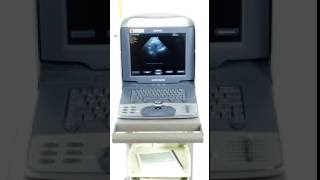 Presenting Siemens Acuson Cypress Ultrasound Machine with Vascular Probe  Drs Toy Store [upl. by Learsi]