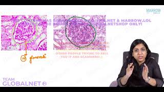 NEPHRITIC SYNDROME By Dr Illa jain khandelwal Pathology by Marrow Video Lecture [upl. by Inajna272]