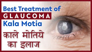 Latest Glaucoma Treatment with Expert Surgeon  kala Motia Ka ilaaj  काला मोतिया का सबसे अच्छा इलाज [upl. by Nehtiek]