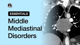 Middle Mediastinal Disorders  Chest Radiology Essentials [upl. by Safire]