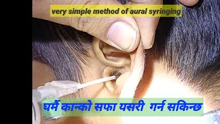 Ear syringing Aural toilet Ear wax removal काने गुजी सफा गरने तरिका 😮 [upl. by Robin]