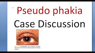 Ophthalmology Pseudophakia History Taking Examination Case Presentation Discussion IOL [upl. by Eelatan]