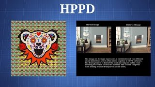 Hallucinogen Persisting Perception Disorder HPPD What You Need To Know [upl. by Kristo]