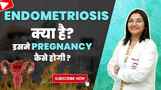 Endometriosis क्या है  What is Endometriosis  Symptoms amp Treatment [upl. by Yecats]