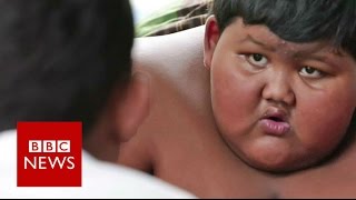 My 10yearold son weighs 188kg  BBC News [upl. by Sigismund981]