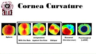 Keratometry and corneal topography [upl. by Novj853]