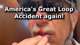 Americas Great Loop  Accident Again  EP22 [upl. by Bogey]