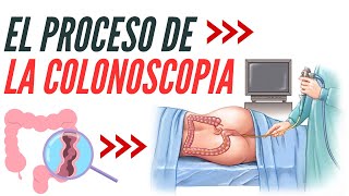 Todo lo que Debes Saber sobre la Colonoscopia y Salud del Colon [upl. by Adnertal608]