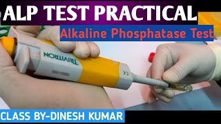 ALP Alkaline Phosphatase Test practical video in hindi [upl. by Trant98]