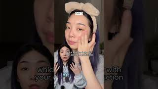 how to use snail mucin and how it helped my acne scars I JUMISO SNAIL MUCIN 🐌 shorts [upl. by Loise957]