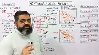 Erythroblastosis Fetalis UrduHindi medium  Prof Masood fuzail Haemolytic Anaemia of Infants [upl. by Chesna]