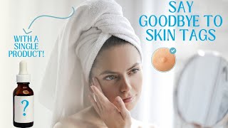 Skin Tag Removal  Causes and Treatment [upl. by Dragoon]