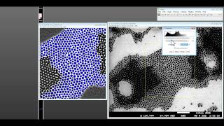 How to use ImageJ for nanoparticle size distribution analysis [upl. by Aelram]