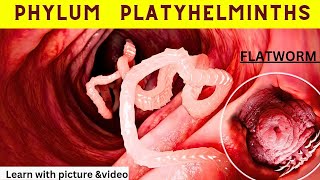 Flatworms चपटेकृमि  phylum platehelmenthis in hindi  flatworm in human  flatworm hindi [upl. by Akinimod117]