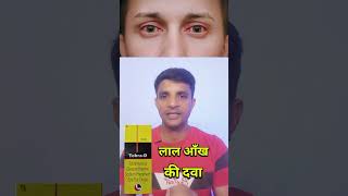 लाल आँख की दवा।। tobra d eye drop shorts short trending youtube [upl. by Eirbua204]