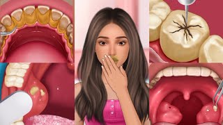 ASMR dental treatment animation 🦷satisfying tartarcaries removal Removal of tonsil stones [upl. by Dafodil]