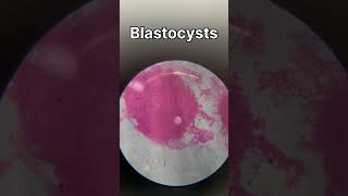 TS of ovary  TS of testis  ringworm bacteria under microscope biology animalkingdomclass11 [upl. by Anyk]