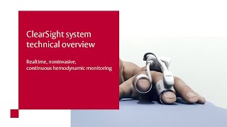 ClearSight system technical overview [upl. by Ramberg893]