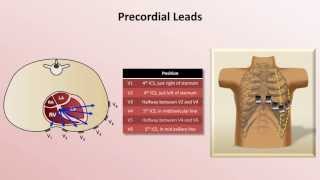 Intro to EKG Interpretation  EKG Leads [upl. by Lynd]