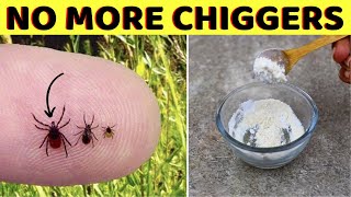 How to get rid of chiggers in your home and keep them away for good [upl. by Yaron827]