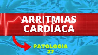 ARRITMIAS CARDÍACA  PATOLOGIA 27 [upl. by Merkley]