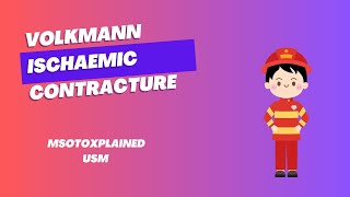 Volkmann Ischaemic Contracture  VIC [upl. by Orling168]