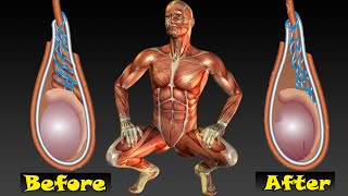 Varicocele exercise for men [upl. by Ira]