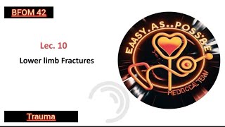 Lecture 10  Lower Limb Fractures  Trauma 42 [upl. by Aihsein]