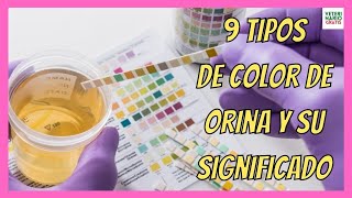 9 TIPOS DE ⚠️ COLOR DE TU ORINA ⚠️ Y SU SIGNIFICADO PARA TU SALUD [upl. by Derdlim]