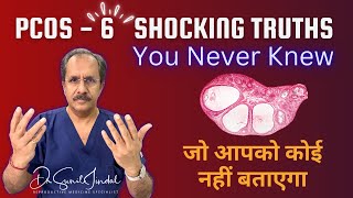 PCOS EXPERT Reveals 6 Shocking Truths You Never KnewDr Sunil JindalJindal Hospital Meerut [upl. by Lan378]