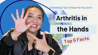 Arthritis in the HandsTop 5 Facts to know when you have hand arthritis [upl. by Dadirac496]