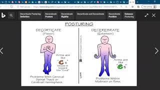 Decorticate and Decerebrate posturingNCLEX Exam Nursing Medical Student [upl. by Aneret]