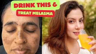 Drink this to treat Melasma amp Pigmentation  Nipun Kapur [upl. by Chien]