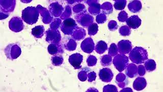 Mast cell tumour overview and cytology [upl. by Nachison]