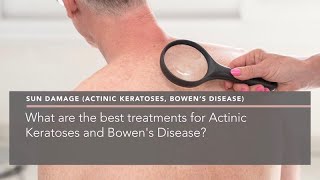 What are the best treatments for Actinic Keratoses and Bowens Disease [upl. by Funch]