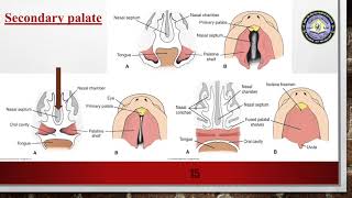 Medical Embryology  Head and neck Development  Tongue Thyroid gland  Face  Nasal cavity  Teeth [upl. by Kirimia]