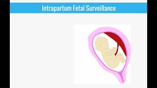 Intrapartum fetal monitoring everything explained [upl. by Sprague177]