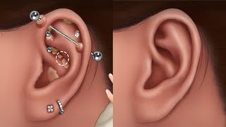 ASMR Piercing Cleaning Animation Blackhead Removing Pus from Piercingkilen Ear Infection Treatment [upl. by Imuya]