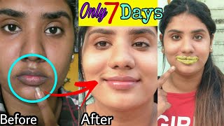 I followed🔥7 Days Challenge🔥How To Lighten Dark Lips Naturally At Home100 ResultNo side effects [upl. by Elleirad]