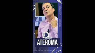 Radiodoc  ATEROMA 2 [upl. by Cheslie525]