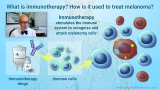 How is melanoma treated with immunotherapy [upl. by Mohandas]