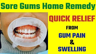 Sore Gums Home Remedy  Quick Relief From Gum Pain and Swelling  5 Minute Home Remedies [upl. by Nessah]