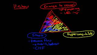 Thromboembolic Disease Deep Vein Thrombosis and Pulmonary Embolism [upl. by Ajar]