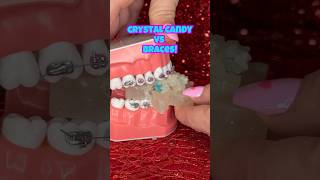 Are crunchy CRYSTAL CANDIES safe for BRACES ASMR eating shorts asmr braces [upl. by Netaf806]