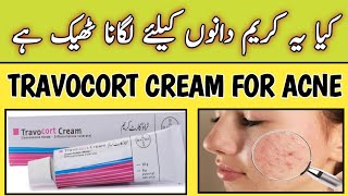 Travocort Cream Used For Acne  Travocort Cream [upl. by Acassej597]