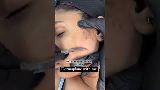 Dermaplaning trending skin skincareroutine skin treatment facial viralvideo face [upl. by Reisman]